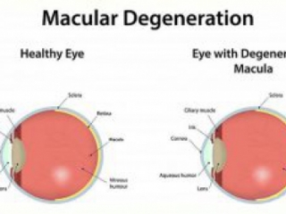 Macular